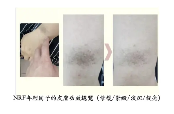 NRF　SKIN　EFFECTS